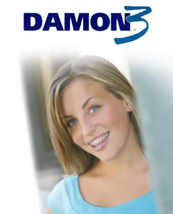 damon3